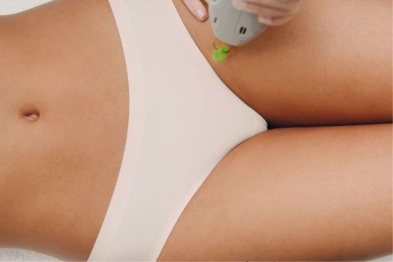 triet-long-bikini-tao-hinh-1