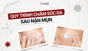 quy-trinh-cham-soc-da-sau-nan-mun-voi-Neutidi